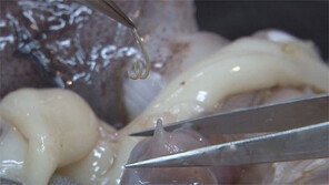 고래회충의 진실, 자연산 횟감 사서 해부해보니…