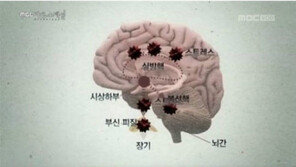 번아웃증후군이란, 극도의 피로감으로 기력을 소진한 상태…예방법은?
