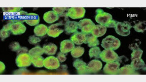 일본 식인 박테리아로 ‘공포’…291명 감염에 71명 사망 ‘충격’