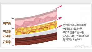 주름지고 처진 얼굴과 헤어지는 이별의 기술, 안면거상술