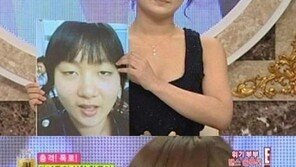박나래, 성형수술 비포 & 에프터 사진 비교해 보니…