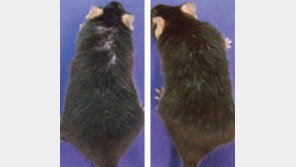 “탈모 방지하려면 모낭줄기세포 노화 막아야”