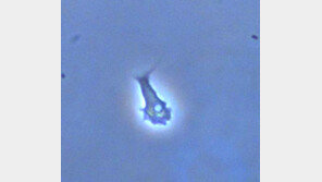 낙동강 아메바, 미기록종 3종 발견