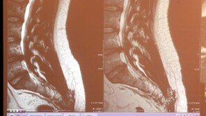 [속보]법원 “박원순 아들 병역비리 의혹 사실 아니다”