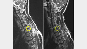 [Health&Beauty]두개의 구멍에 내시경 따로 수술기구 따로