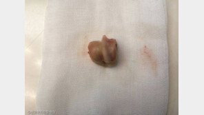 "이 미친 X아, 이걸 왜 먹었어"