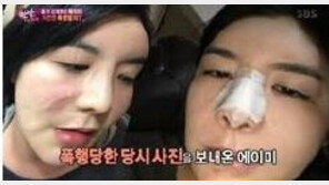 에이미, 美 길거리서 쓰러져 응급실행 “폭행 충격으로 쇼크상태”