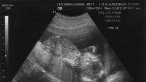 “어머니가 임신하셨습니다”… 91세 노인의 임신, 가능한가?