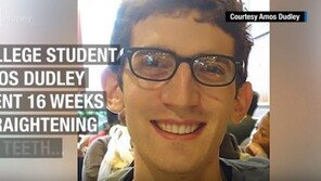 3D 프린터로 ‘셀프 치아 교정’…16주 만에 이런 결과를?