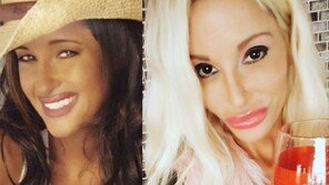 6억 들여 성형 수술한 여성 ‘화제’