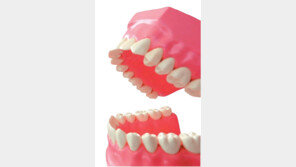 [Bio의학]시린이, 전용치약-부드러운 칫솔로 관리 