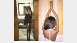 너무 깡마른 여성 모델, 아빠는 걱정 “SNS 때문”