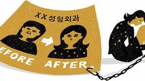 “성형수술 반복자, 어린시절 학대 받았을 가능성 높다” 