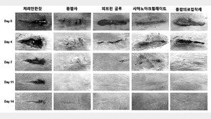 피부상처부터 속살-뼈까지 접착제로 붙인다