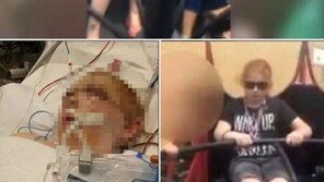 ‘놀이기구 타다 두피 벗겨진 소녀 중태’ 끔찍, 괴담 현실로… 