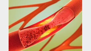 [Health&Beauty]커져가는 고혈압·고지혈증 복합제… 꼼꼼하게 따져봐야