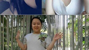 30대 얼굴에서 10대 얼굴로…60kg 뺀 여성