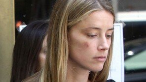 엠버 허드, ‘가정폭력’으로 조니 뎁 고소…멍 든 얼굴 사진 찍혀