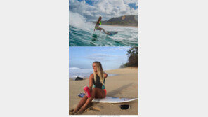 상어에 한 팔 잃은 여성 서퍼