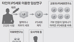 他人 만능줄기세포 이용… 日, 망막세포이식 첫 실험 