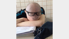 숙면을 위한 삭발 두피 ‘웃음’