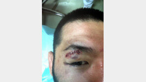 [로드FC] 후쿠다 리키 훈련 중 부상…7월2일 김훈과의 대결 무산