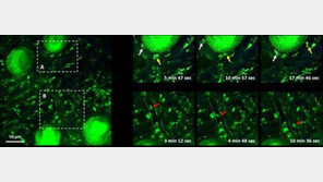 항생제로 암세포 3차원 촬영 기술 개발…부작용도 적어