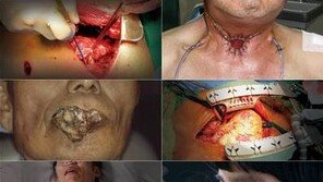 담뱃갑 경고그림 부착 12월 23일부터 시행…최종 확정 경고그림 10종은?