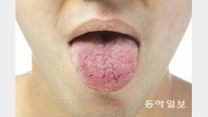 [Health&Beauty]‘입이 바싹’ 3개월 이상 지속되면 류마티스내과 방문하세요