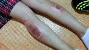 “참된 가정교육 vs 학대”… 외박한 여고생에 회초리, ‘설전’