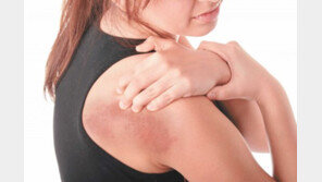 [Health&Beauty]더위에 지친 몸에서 통증 폭발… 대상포진, 참지말고 치료를