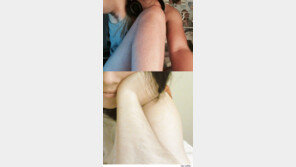 체모가 어때서? 프랑스 여성들의 ‘온라인 항의’