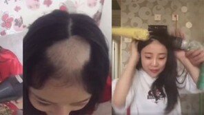 전동 드릴에 옥수수 끼워 먹다 머리카락이 ‘뭉텅이’로…