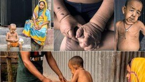 4세 아이 얼굴이… “힘내라 호사인!”