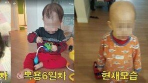 3세 아이, 한약 때문에 탈모? 의협VS한의협 공방으로 확대