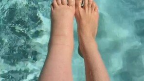 왼쪽 다리가 2배 더 굵은 전직 女모델의 당당함에 응원 쇄도 