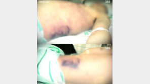 ‘윤일병 사건’ 주범 징역 40년 확정…부검 서울대 교수 “시신 교통사고·추락사 수준”