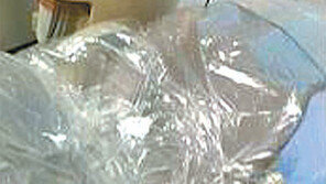 HIV감염자 스케일링할때 의자에 비닐 덮으면 인격침해?