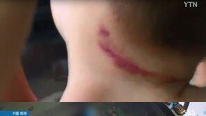 목 조르고 굶기고 때리고…또 인천에서 어린이집 아동학대