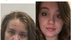 826일 간 마약 끊은 女 ‘비포 애프터’ 사진, 감동 그 자체