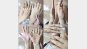 ‘구르미 그린 달빛’ 박보검 동생 정혜성, 통통한 손 분장이 장갑?…“뺨 맞으면 십리 밖으로 날아가요”