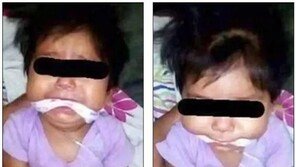 9개월 아기 재갈 물리고 양손 포박해 사진 찍은 母, 관심 끌려고? 
