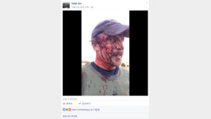 같은 곰에게 2번 공격받고 살아남은 男…피투성이로 “난 살아있다”