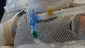 몸 불편한 친구에 휘발유 붓고 불 붙인 10대들, 이유 들어봤더니… 