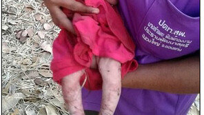 母 칼에 14차례 찔린 뒤 생매장 된 신생아, 극적으로 살아나