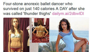 체중 25kg 나가던 10대 女, 몸무게 2배 늘자 미모 ‘폭발’