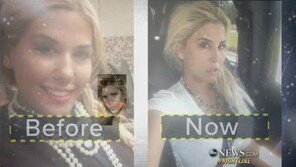 “‘OOO’ 딸처럼 해주세요” 수천만 원 들고 성형외과 찾는 여자들 