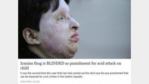 염산 뿌려 4세 소녀 실명케 한 폭력배, ‘눈에는 눈’ 규정 따라 결국…