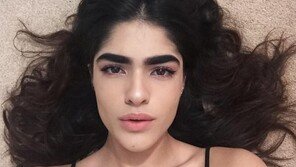 ‘숯검정 눈썹’ 탓 왕따 여고생, 세계적 모델 에이전시와 계약 ‘인생역전’