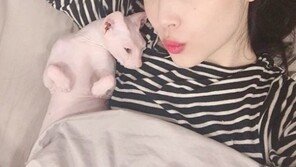 설리 “실수로 다쳤어요, 걱정끼쳐 미안해요” 양팔 들어올린 사진으로 안부전해…